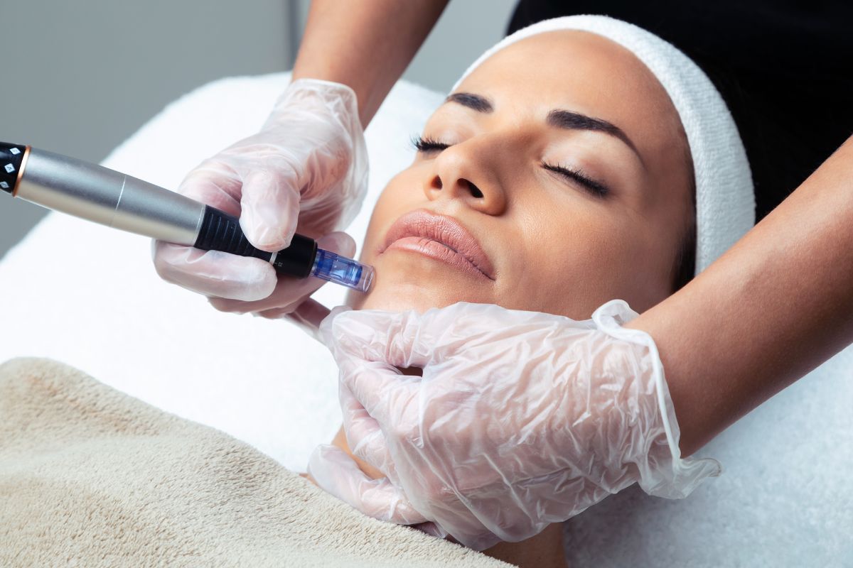Microneedling Aftercare: Do’s and Don’ts For Best Results